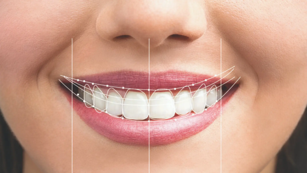 digital smile design