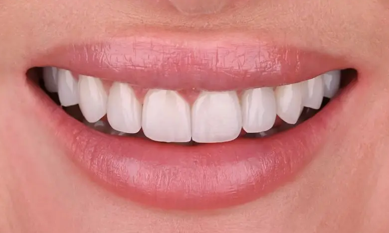 Smile Gallery Image 8