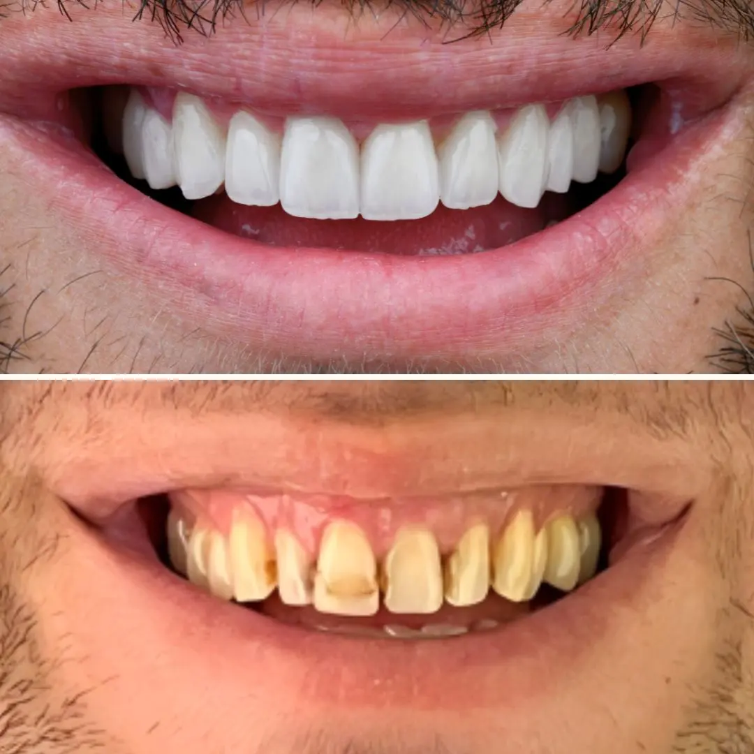 Smile Gallery Image 6