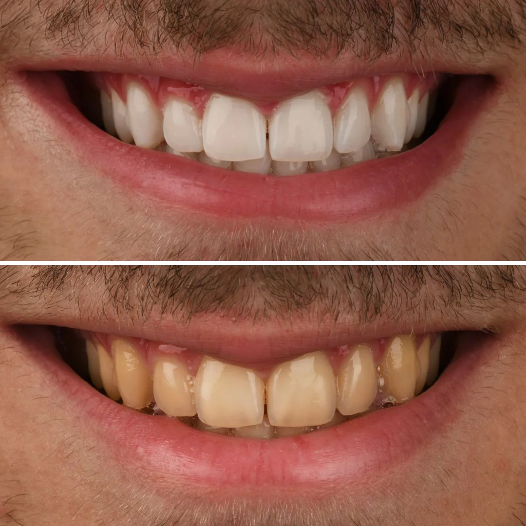 Smile Gallery Image 4