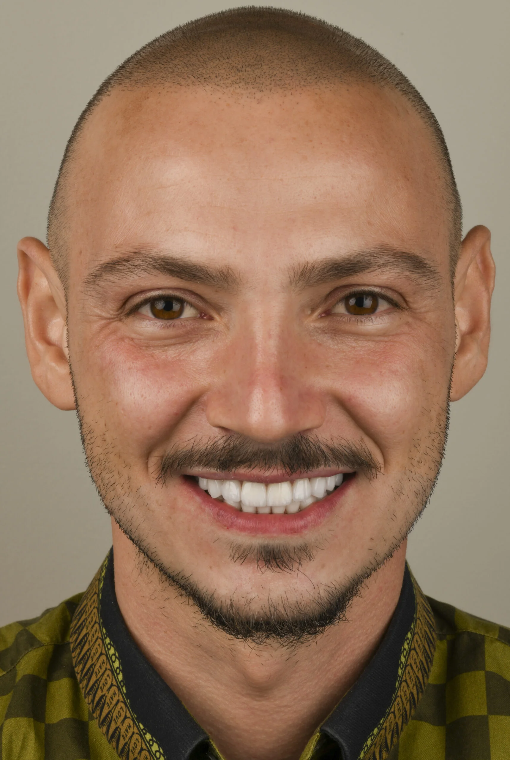Smile Gallery Image 3