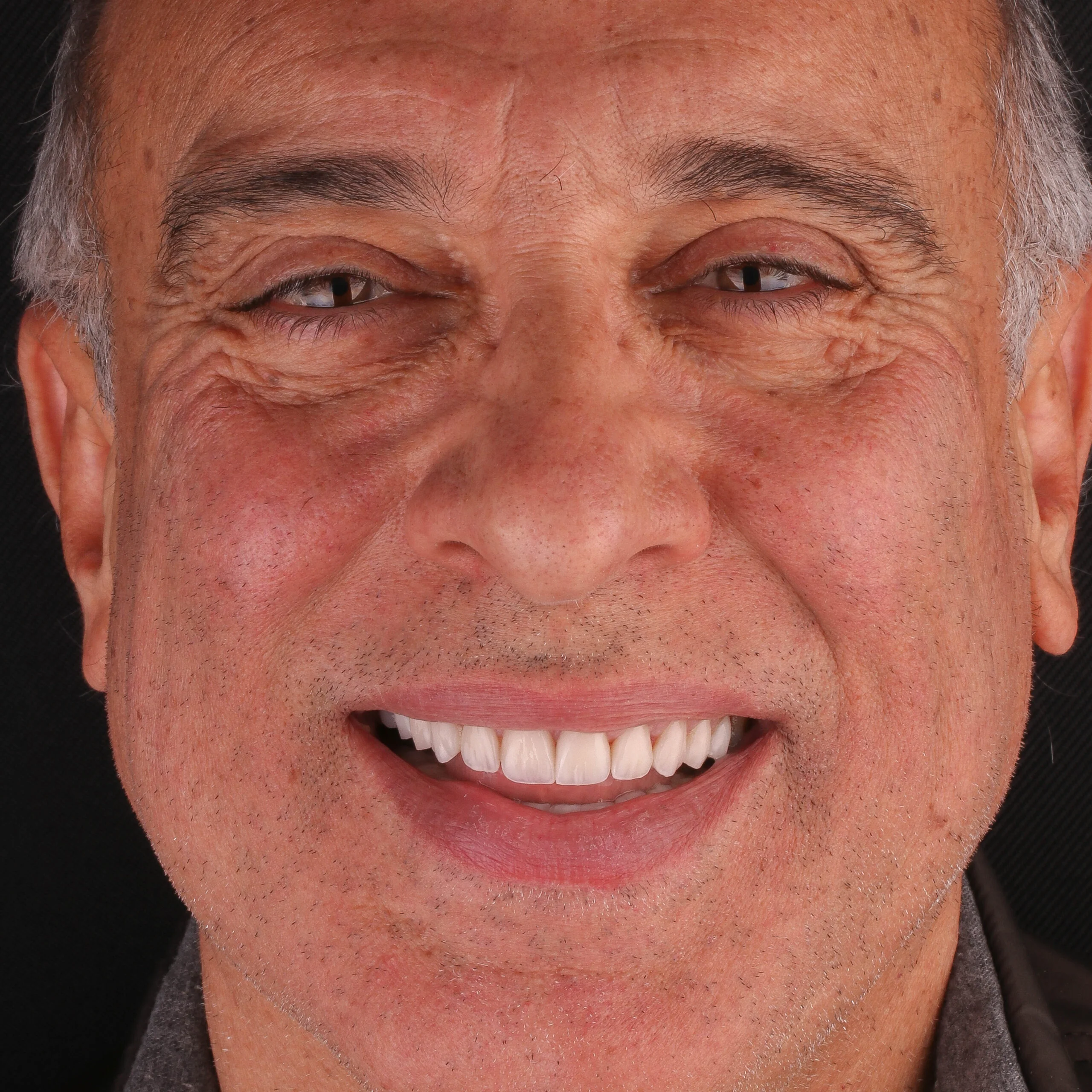 Smile Gallery Image 9