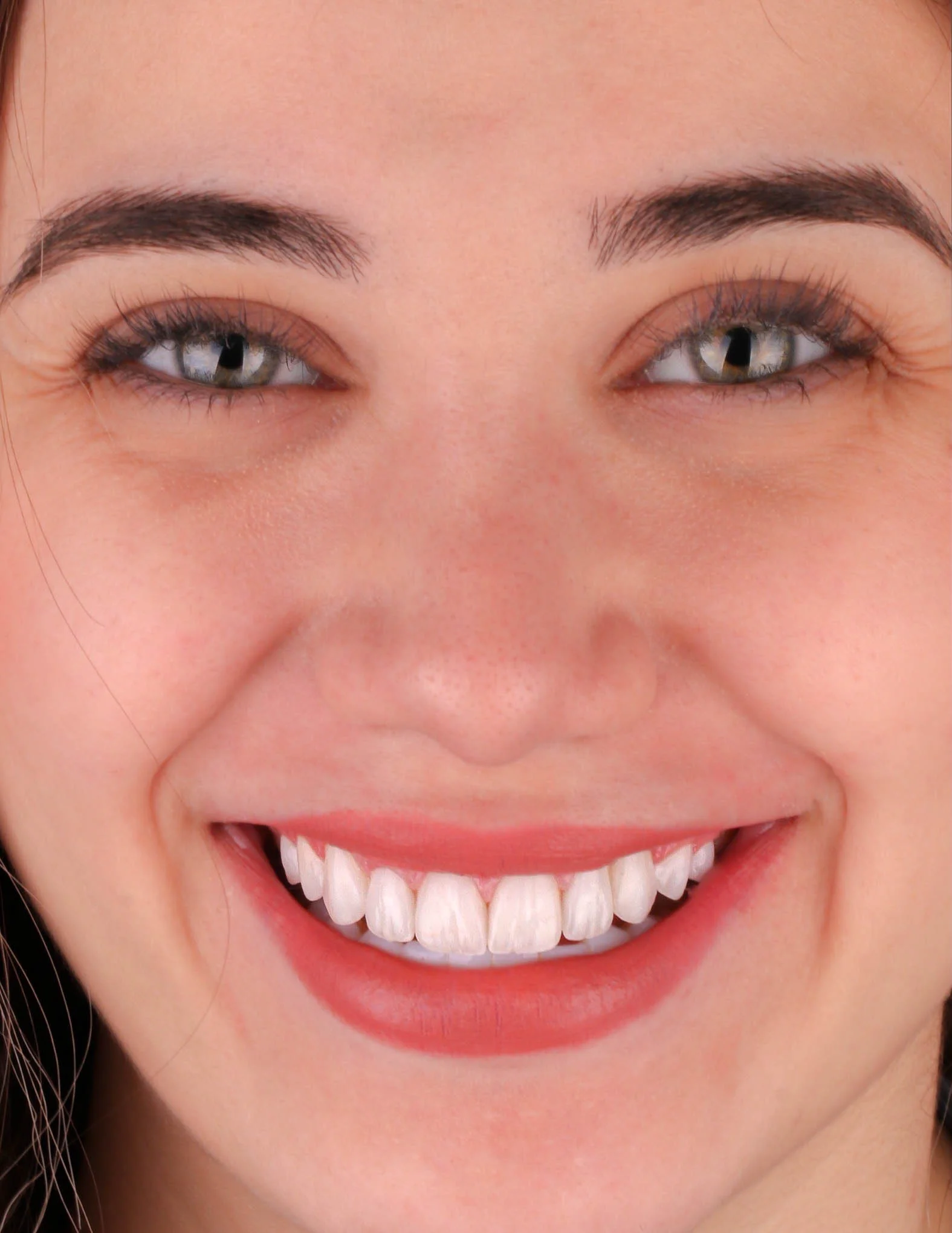 Smile Gallery Image 5