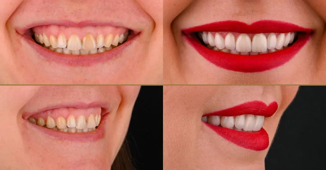 Smile Gallery Image 7