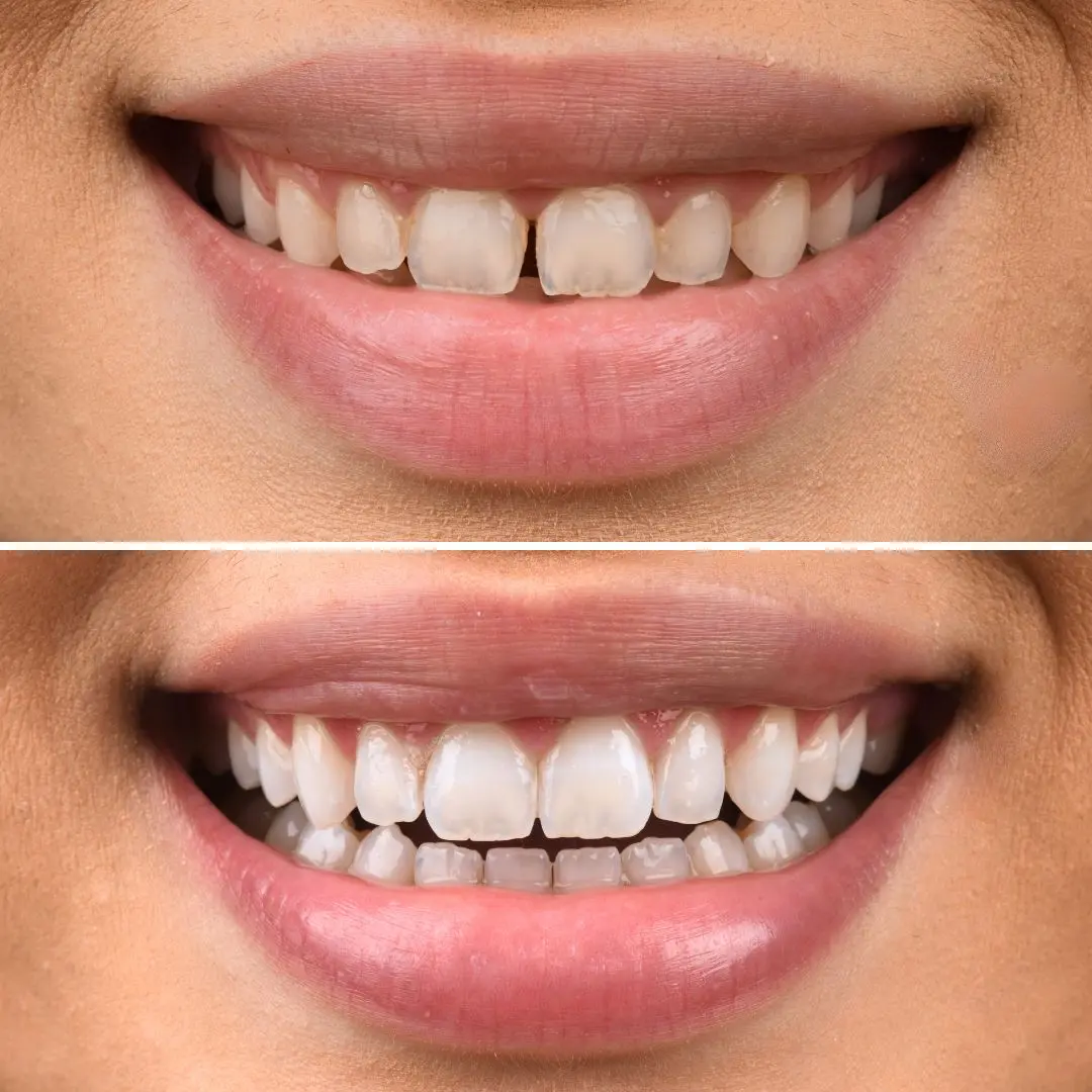 Smile Gallery Image 10