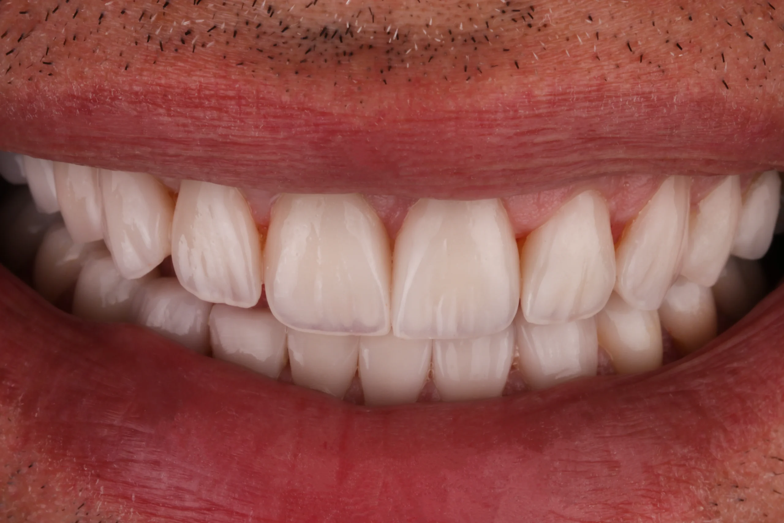 Smile Gallery Image 1