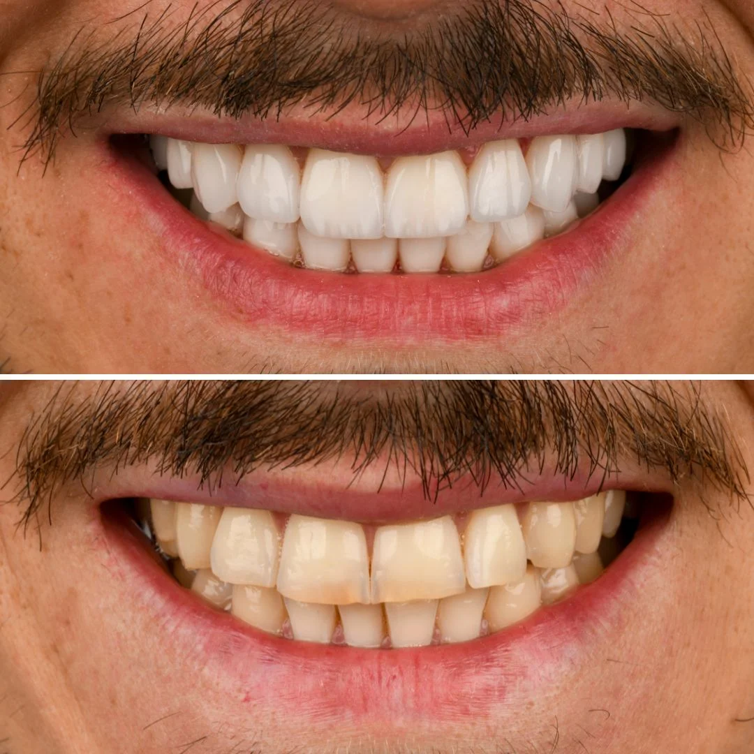 Smile Gallery Image 2