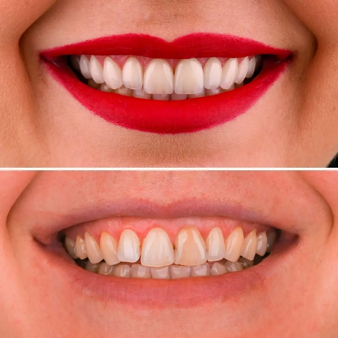 Smile Gallery Image 4